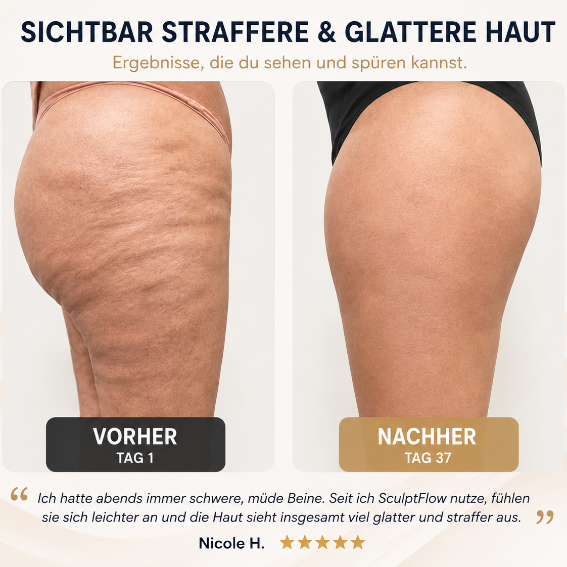 SculptFlow™ – sichtbar straffere & glattere Haut Mirevo